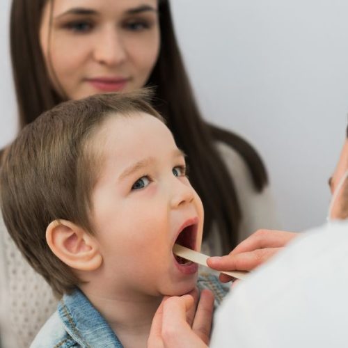 Mouth Ulcers in Kids