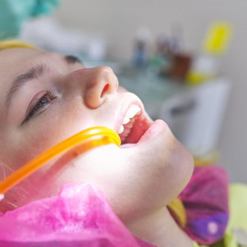 fluoride treatment for kids