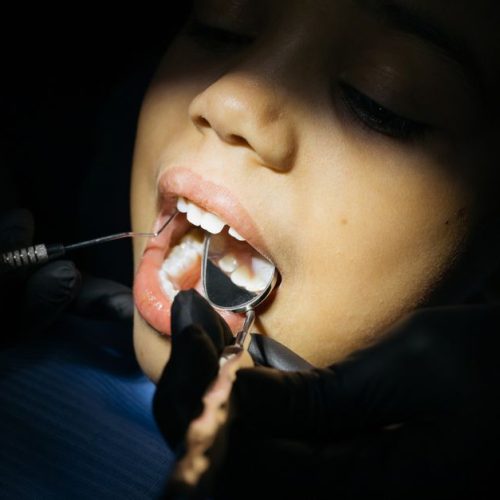 Signs of a cavity in a child